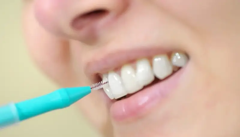 Leczenie kanałowe Warszawa gdzie najlepiej